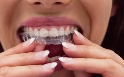 Invisalign Pembroke Pines: Clear Aligner Therapy for Discreet Orthodontic Correction